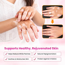 Itivedam Dermosanjivni Vitiligo Care Lotion