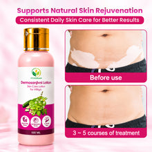 Itivedam Dermosanjivni Vitiligo Care Lotion