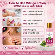 Itivedam Dermosanjivni Vitiligo Care Lotion